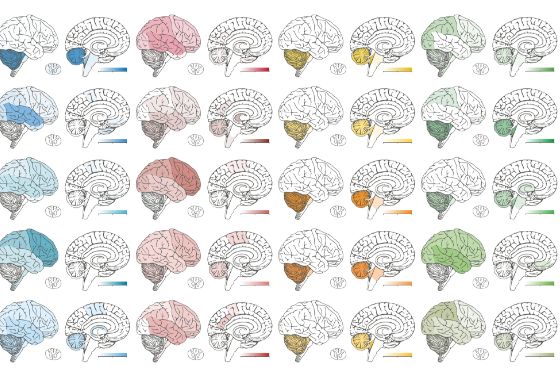 Künstliche Intelligenz unterstützt Krebsdiagnose bei Kindern